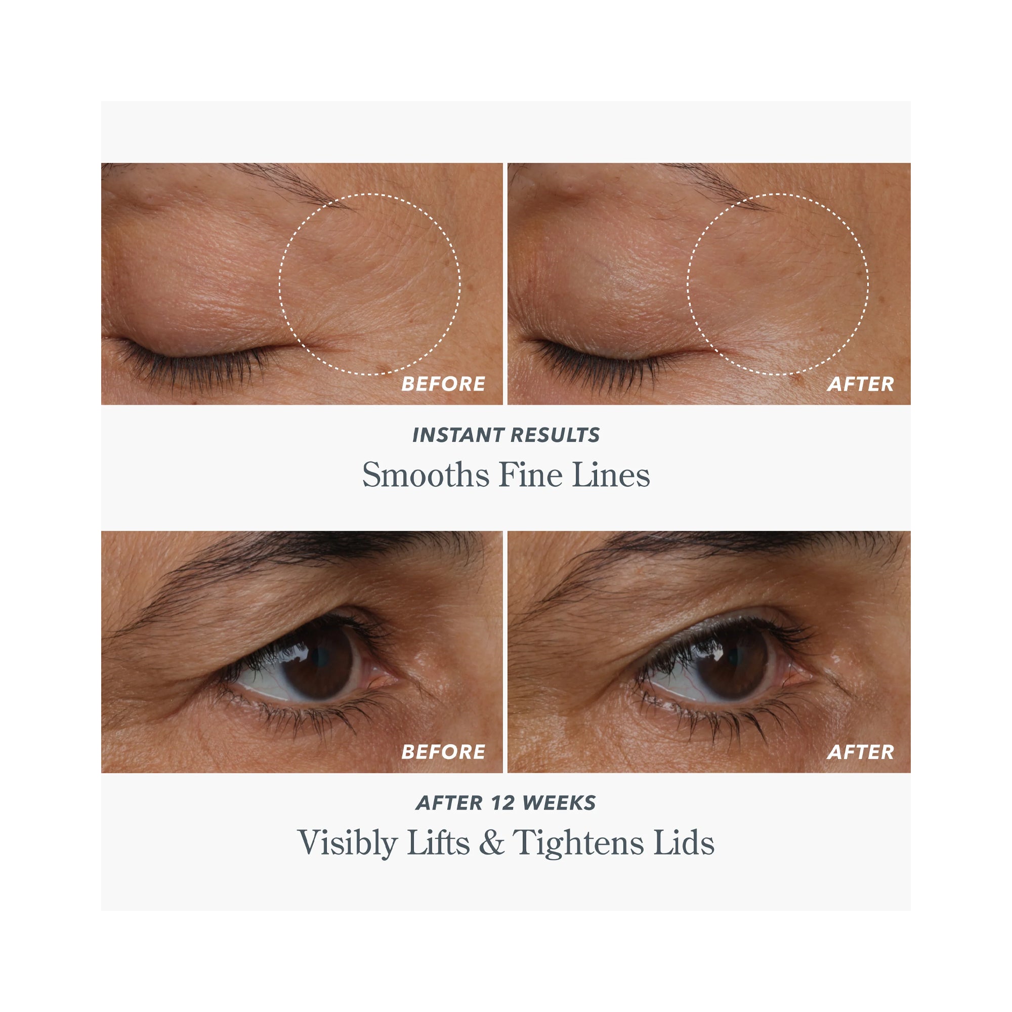 BEEKMAN 1802 Milk RX Advanced Better Aging Dual Eye Treatments / 0.68OZ