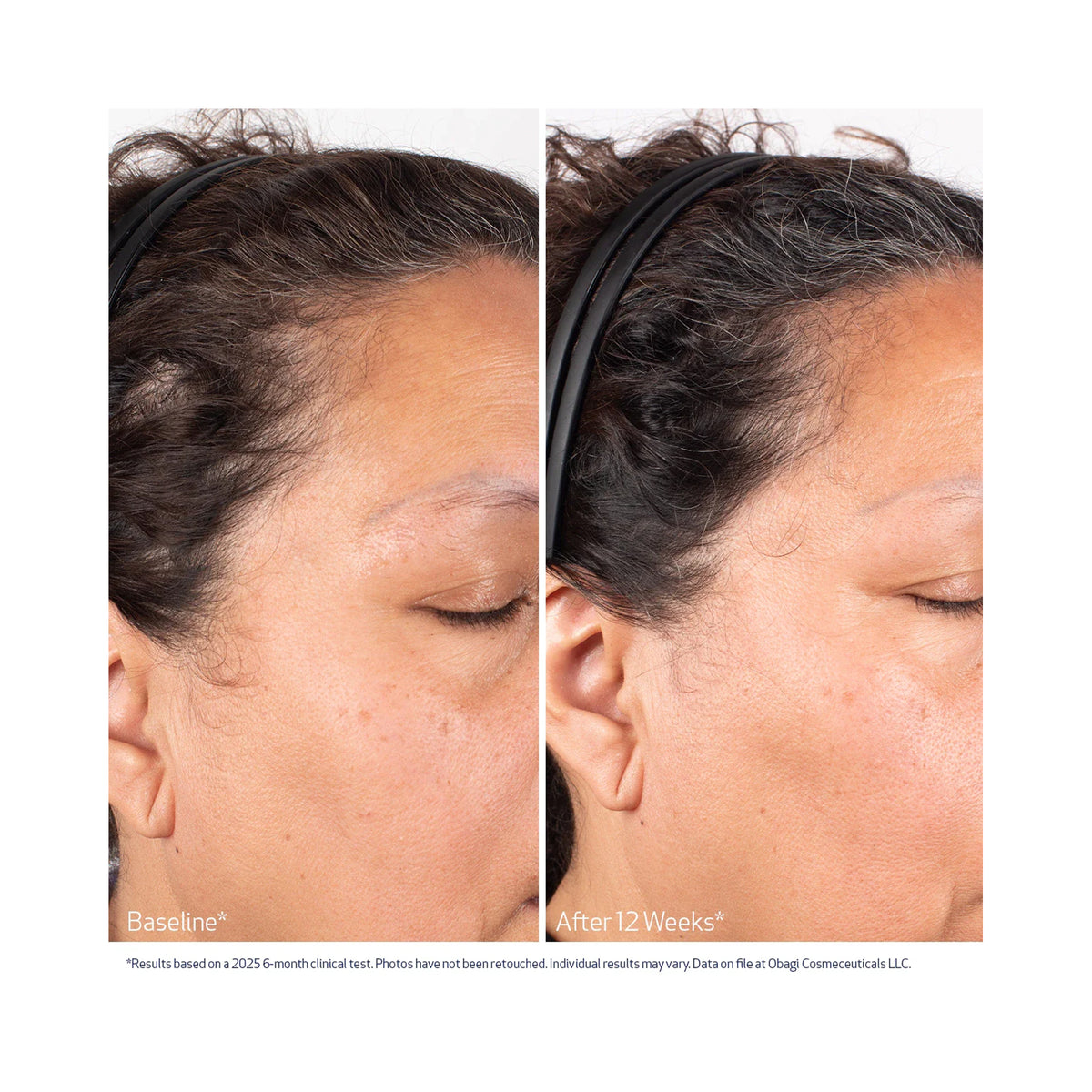 Obagi Nu-Cil BioStim Scalp Serum / 2OZ, image 31062832808086