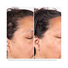 Obagi Nu-Cil BioStim Scalp Serum / 2OZ