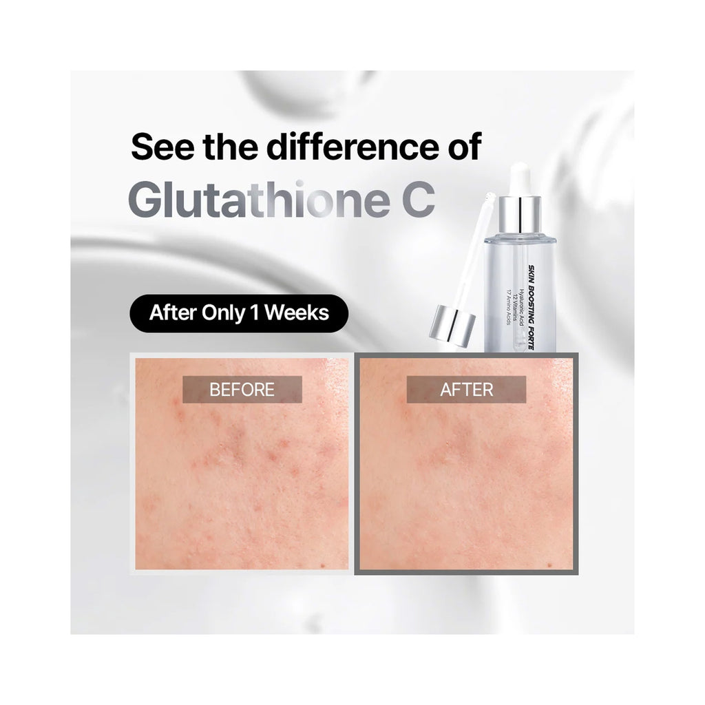 Essenciel Skin Boosting Forte Ampoule, before and after  effect after 1 week thumbnail 5
