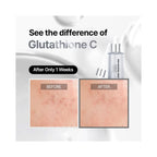 Essenciel Skin Boosting Forte Ampoule, before and after  effect after 1 week