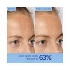 Caudalie VinoPerfect Dark Spot Brightening Routine - Holiday 2026 / SET
