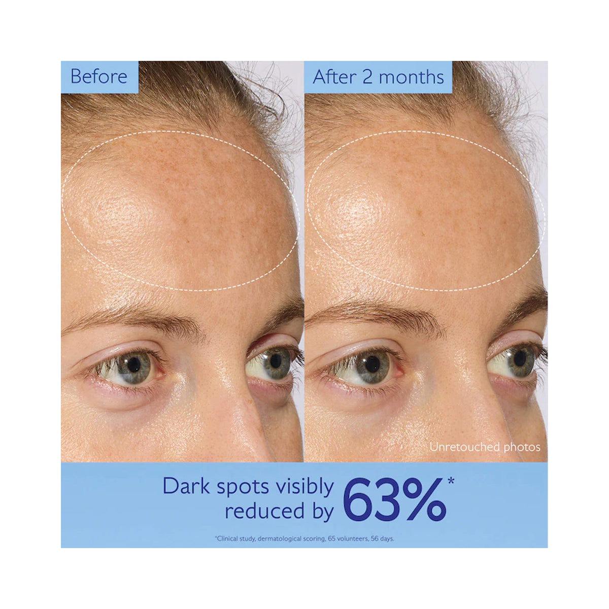 Caudalie VinoPerfect Dark Spot Brightening Routine - Holiday 2026 / SET, image 46214698172566