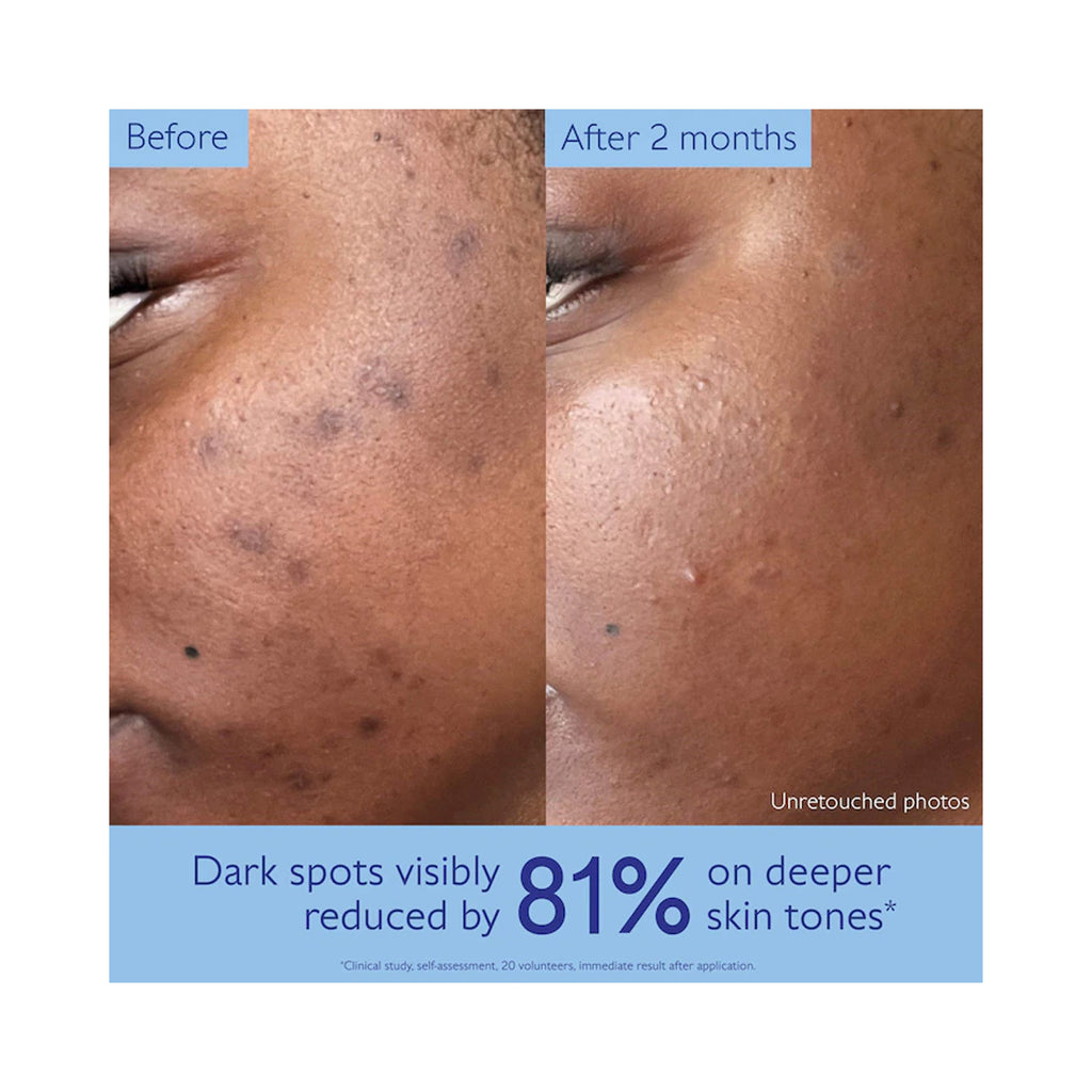 Caudalie VinoPerfect Dark Spot Brightening Routine - Holiday 2026 / SET thumbnail 6