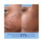 Caudalie VinoPerfect Dark Spot Brightening Routine - Holiday 2026 / SET