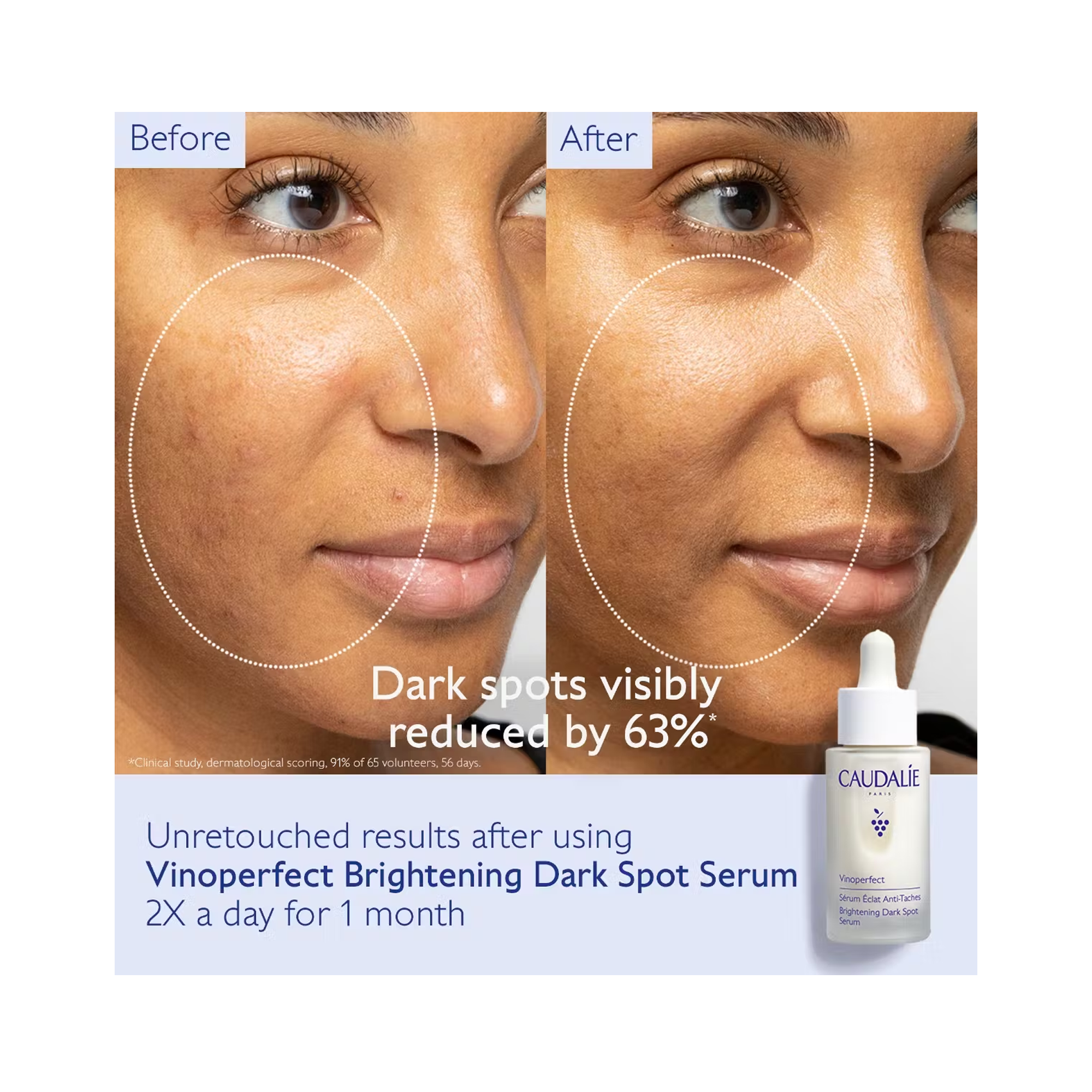 Caudalie_Vinoperfect_Face_Eye_Brightening_Trio / KIT