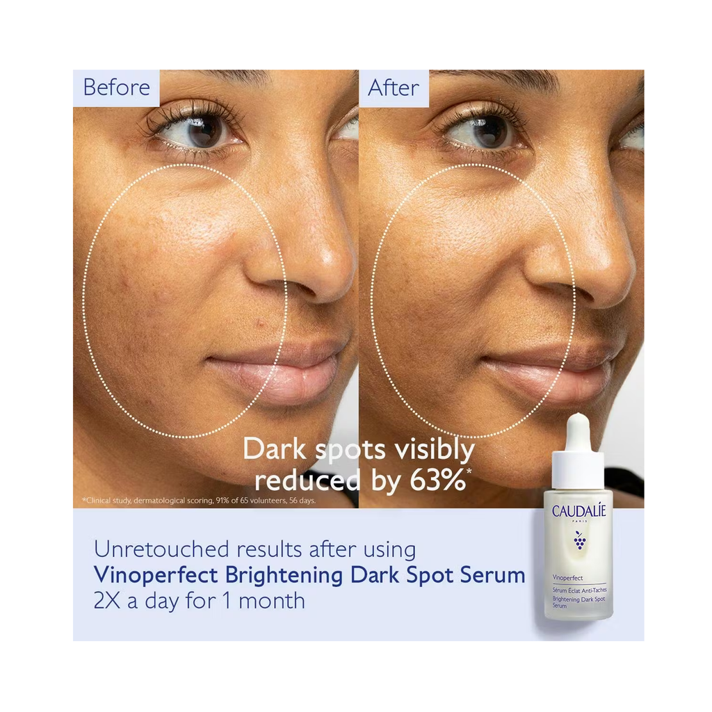Caudalie Vinoperfect Brightening Dark Spot Serum / 1.6 oz thumbnail 9