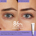 Caudalie Vinoperfect Dark Circle Brightening Eye Cream with Niacinamide / 0.5OZ