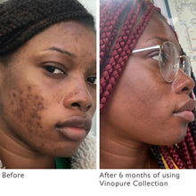 Vinopure Pore Purifying Gel Cleanser / 5OZ