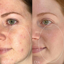 Vinopure Pore Purifying Gel Cleanser / 5OZ