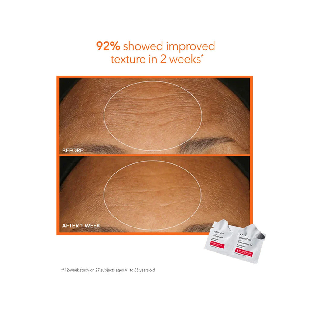 Dr. Dennis Gross The Peel Vault ($250 Value) - Holiday 2026 / KIT thumbnail 5