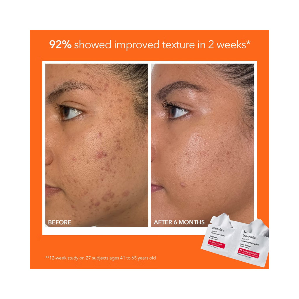 Dr. Dennis Gross Radiant, Smooth & Firm Extra Strength Kit ($130 Value) / KIT thumbnail 6