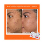 Dr. Dennis Gross Radiant, Smooth & Firm Extra Strength Kit ($130 Value) / KIT