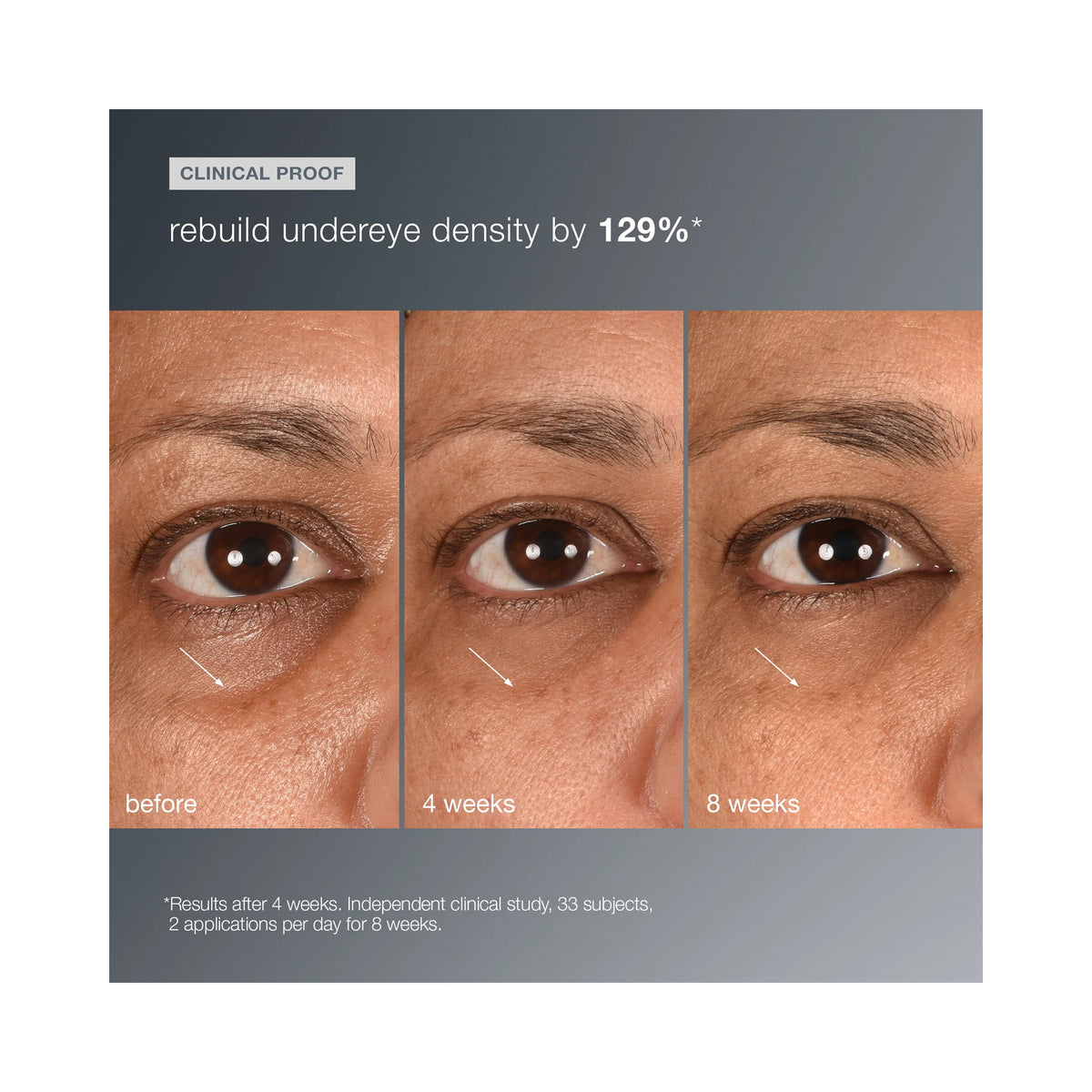 Dermalogica Smart Eye Density Serum / 0.5OZ, image 32906880024726