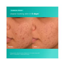 Dermalogica_Acne_Biotic_Moisturizer_1.7oz / 1.7OZ