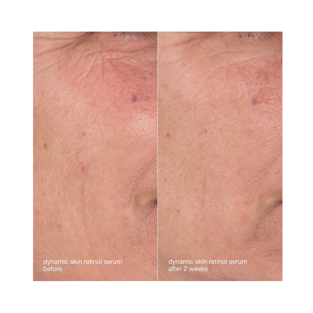 Dermalogica_Skin_Aging_Solutions_Kit / KIT thumbnail 5