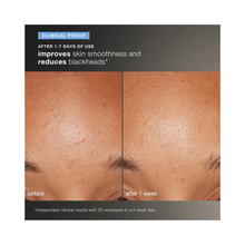 Dermalogica_Daily_Microfoliant_Refill_2.6oz / 2.6 OZ