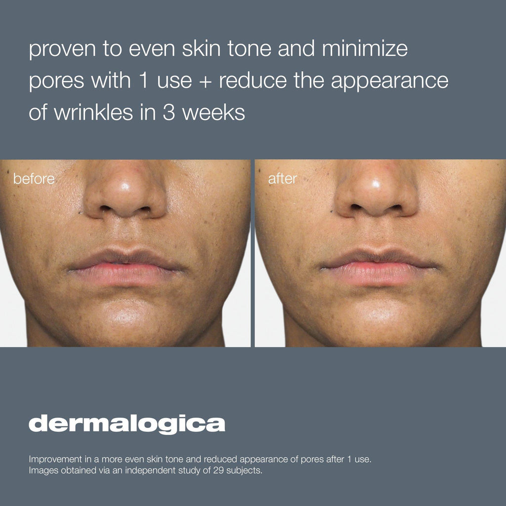 Dermalogica Liquid Peelfoliant / 2OZ thumbnail 3