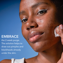 Dr. Dennis Gross Alpha Beta 2% BHA + Breakout Solution / 5OZ