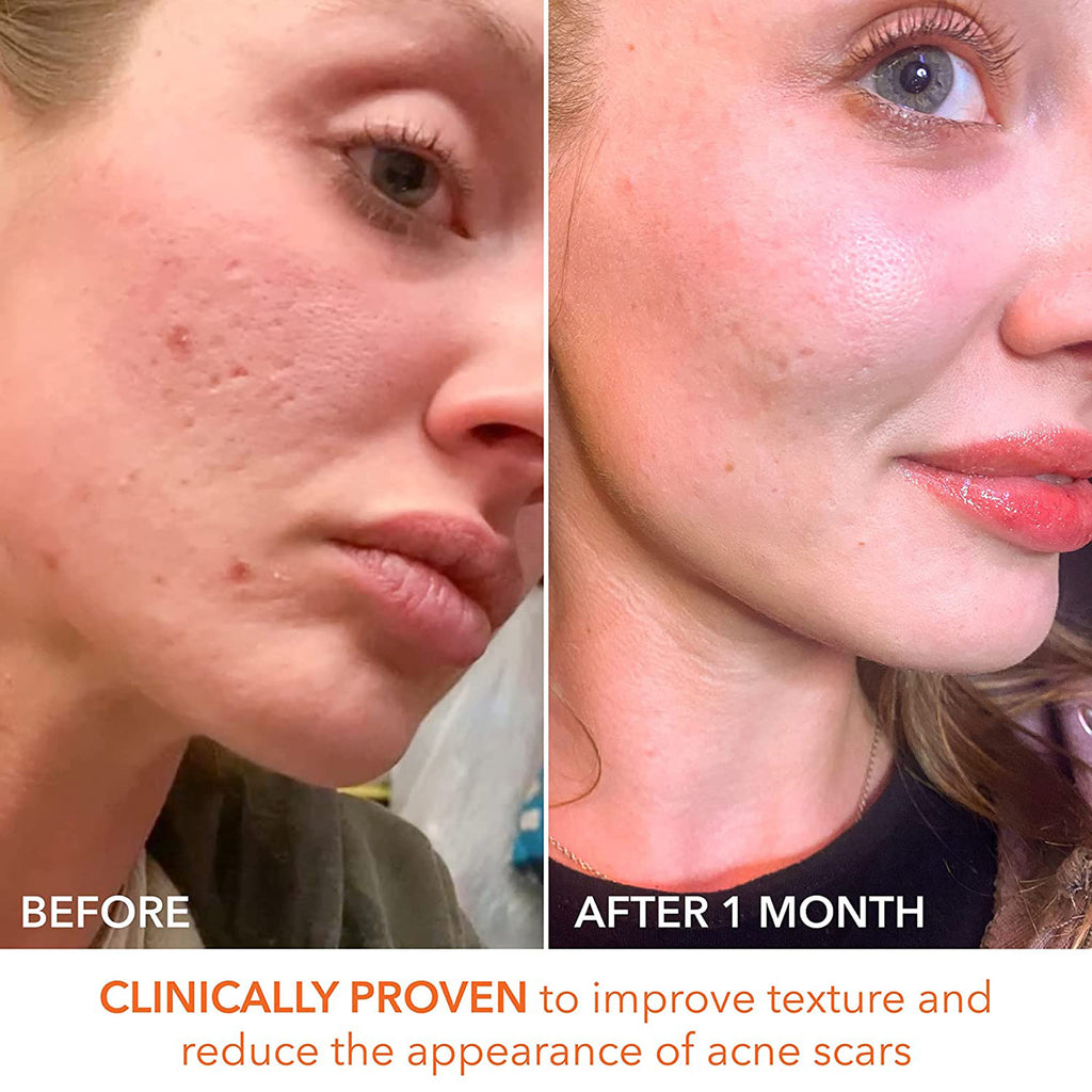 Dr. Dennis Gross Alpha Beta Extra Strength Daily Peel - 30 Packettes / 30PK thumbnail 11