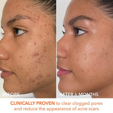 Dr. Dennis Gross Alpha Beta Extra Strength Daily Peel - 30 Packettes / 30PK