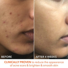 Dr. Dennis Gross Alpha Beta Extra Strength Daily Peel - 30 Packettes / 30PK