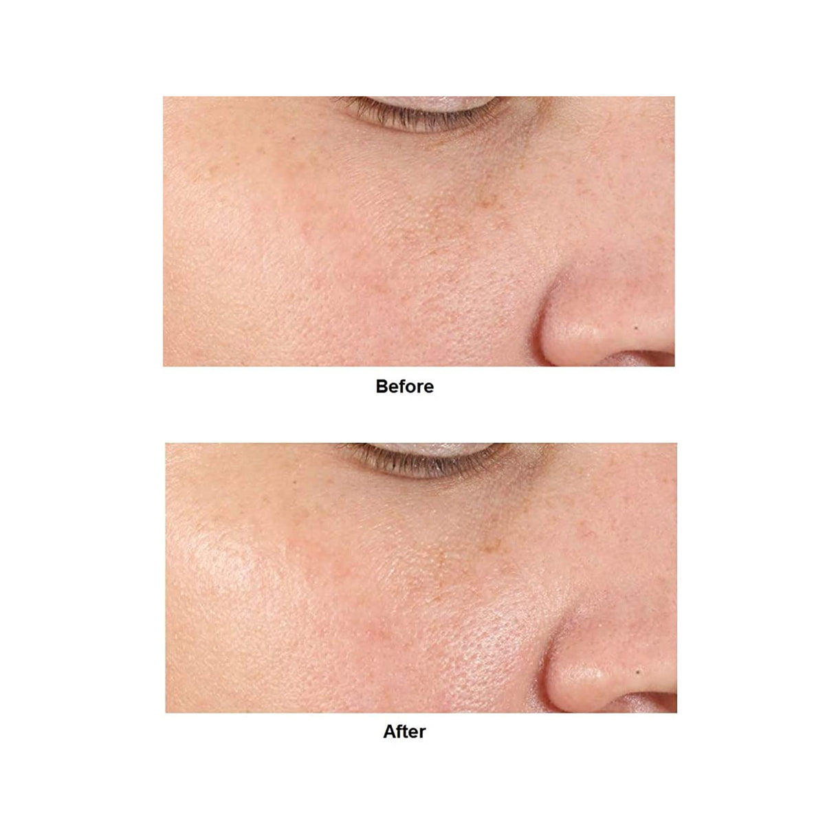 Dr. Dennis Gross Alpha Beta Pore Perfecting & Refining Serum / 1OZ, image 27389532733590