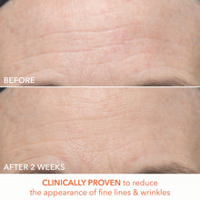 Dr. Dennis Gross Alpha Beta Ultra Gentle Daily Peel - 30 Applications / 30 PK