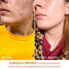 Dr. Dennis Gross Alpha Beta Universal Daily Peel 5 Pk / 5PK