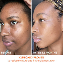 Dr. Dennis Gross Alpha Beta Universal Daily Peel 5 Pk / 5PK