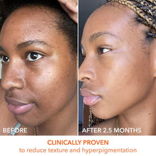 Dr. Dennis Gross Alpha Beta Universal Daily Peel 30 Pk / 30PK