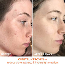 Dr. Dennis Gross Alpha Beta Universal Daily Peel 30 Pk / 30PK