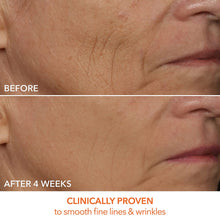 Dr. Dennis Gross Skincare SpectraLite Faceware Pro / WHITE