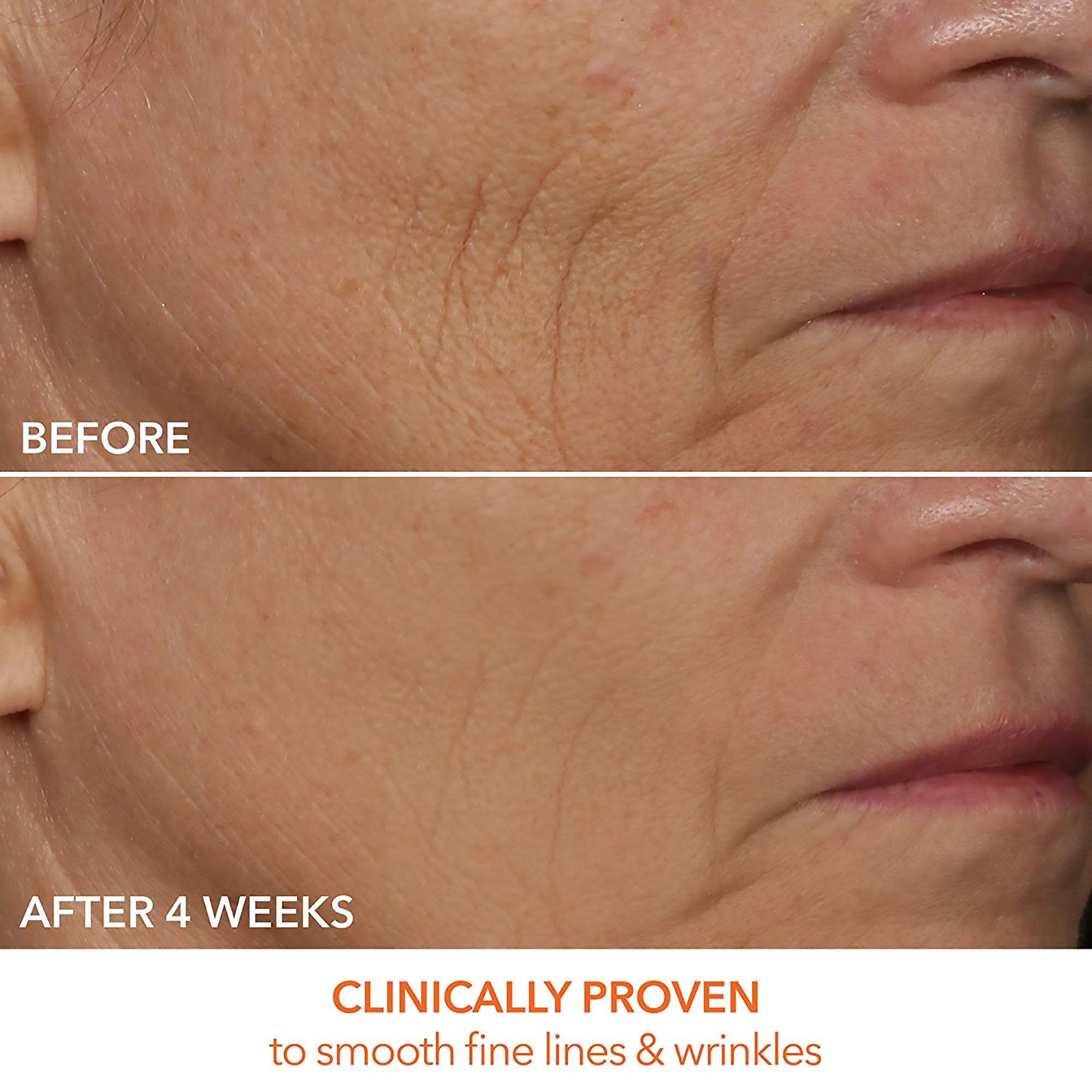 Dr. Dennis Gross Skincare DRx SpectraLite FaceWare Pro