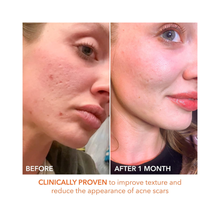 Dr._Dennis_Gross_Alpha_Beta_Extra_Strength_Daily_Peel / 5PK