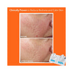 Dr. Dennis Gross Alpha Beta Ultra Gentle Daily Peel - 30 Applications / 30 PK