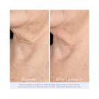 Obagi ELASTIderm Neck & Decollete Concentrate / 2OZ