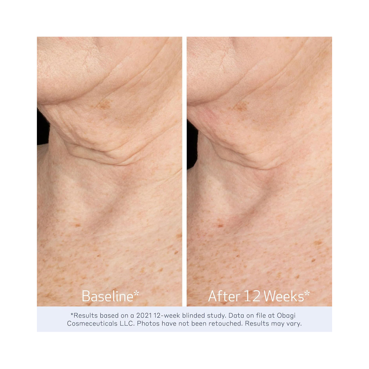 Obagi ELASTIderm Neck & Decollete Concentrate / 2OZ, image 32079619162262