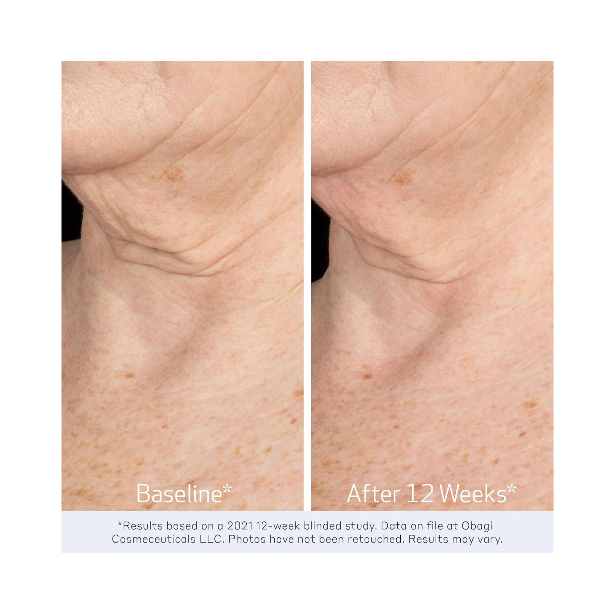 Obagi ELASTIderm Neck & Decollete Concentrate / 2OZ