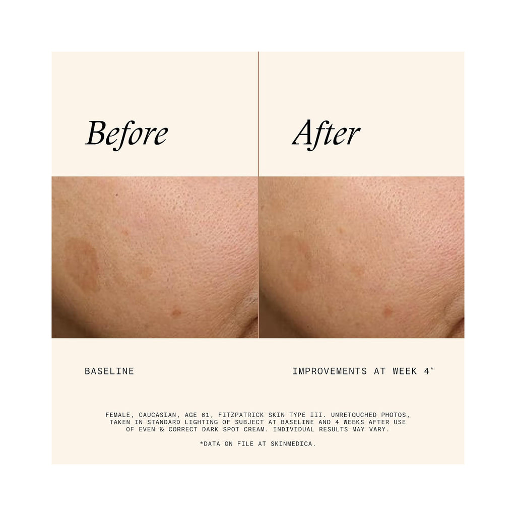 SkinMedica Even & Correct Dark Spot Cream / .5OZ thumbnail 6