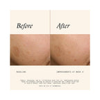 SkinMedica Even & Correct Dark Spot Cream / .5OZ