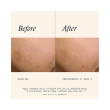 SkinMedica Even & Correct Dark Spot Cream / .5OZ
