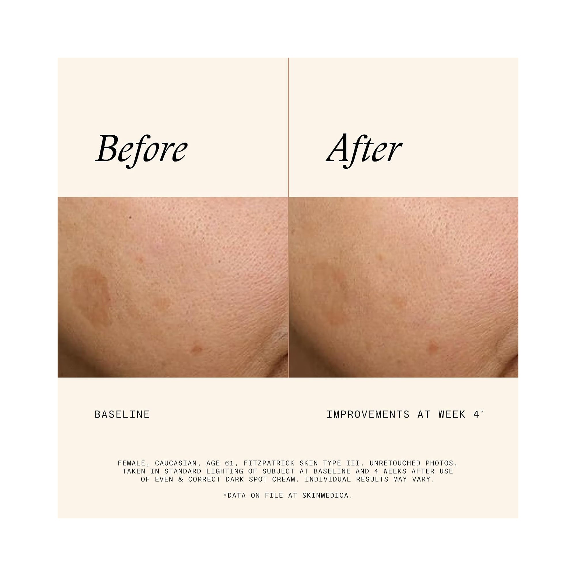SkinMedica Even & Correct Dark Spot Cream / .5OZ