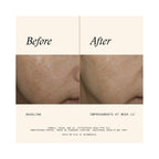 SkinMedica Even & Correct Advanced Brightening Treatment / 1.7OZ