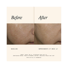 SkinMedica Even & Correct Advanced Brightening Treatment / 1.7OZ