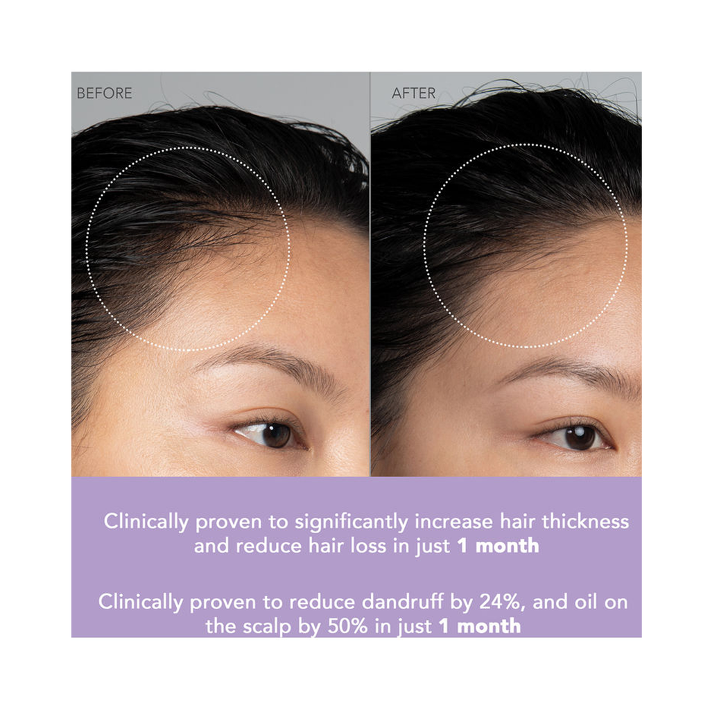 Foreo_LUNA_4_hair_Lavender thumbnail 5