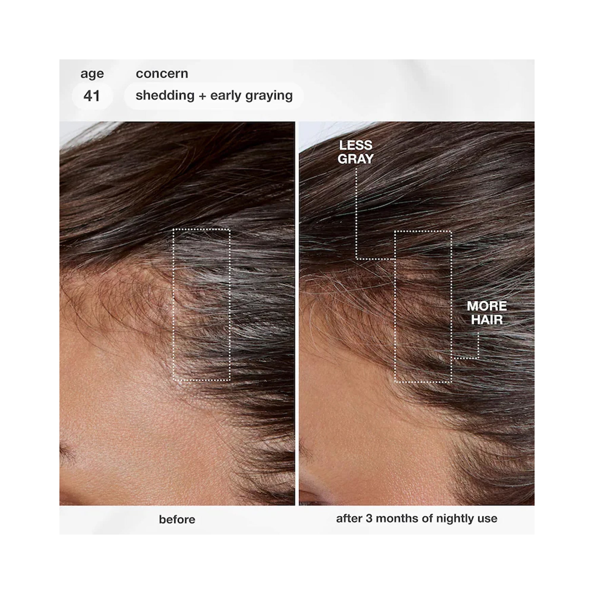 K18 Biomimetic Future IQ Biomimetic Hair Longevity Serum / 3.04OZ