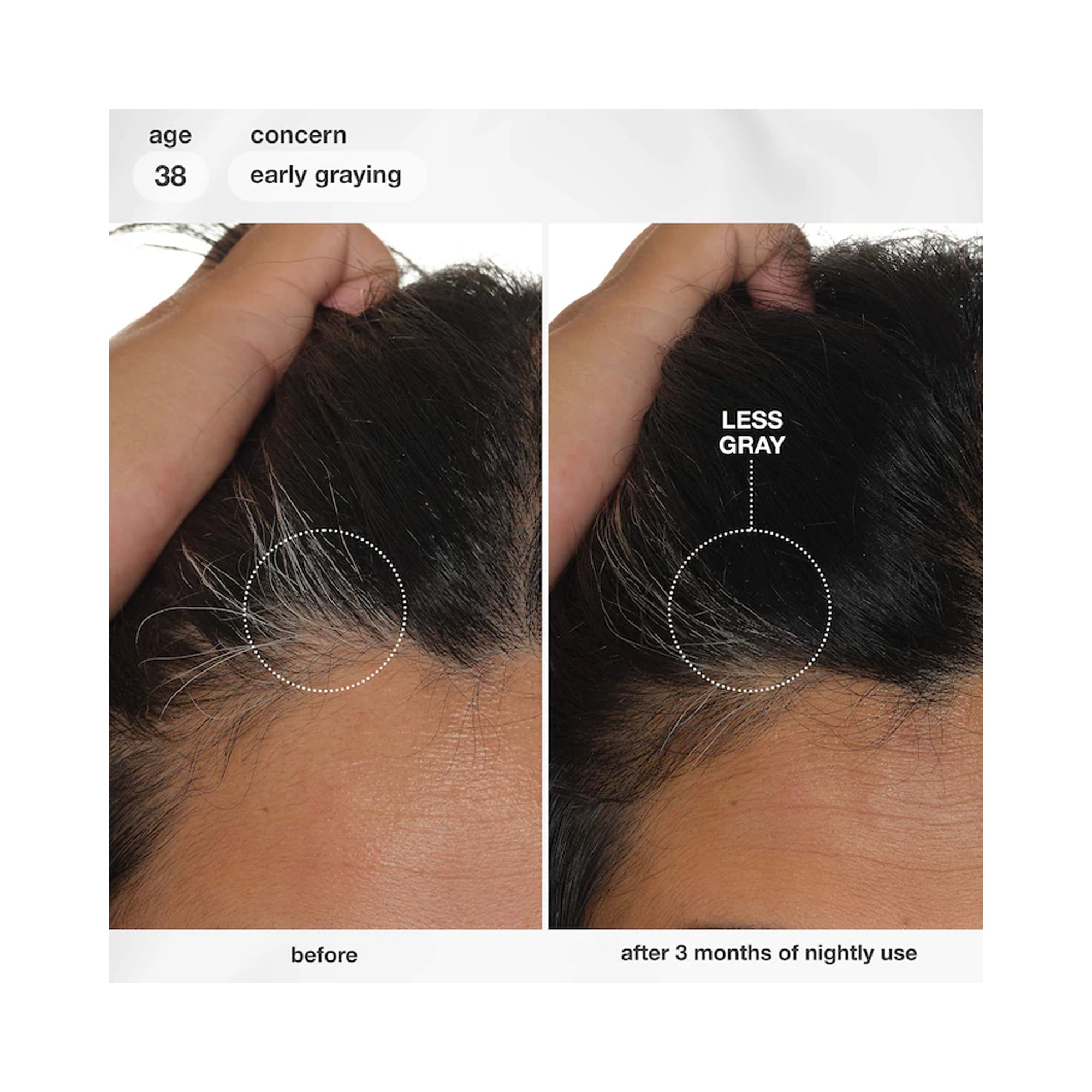 K18 Biomimetic Future IQ Biomimetic Hair Longevity Serum / 3.04OZ