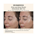 SkinMedica HA5 Hydra Collagen Water Burst Moisturizer / 1.7OZ