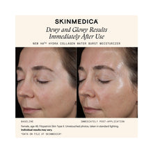 SkinMedica HA5 Hydra Collagen Water Burst Moisturizer / 1.7OZ